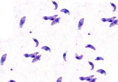 Toxoplasmosis under a microscope